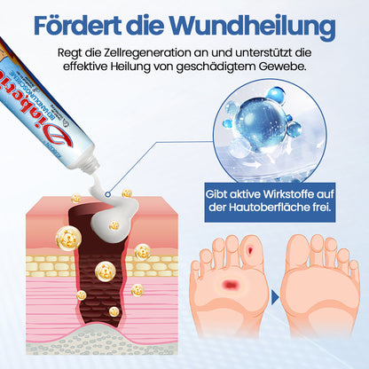 KUBOZN® VitaGluco Diabetes-Behandlungssalbe🌿 Dermatologisch getestet & empfohlen