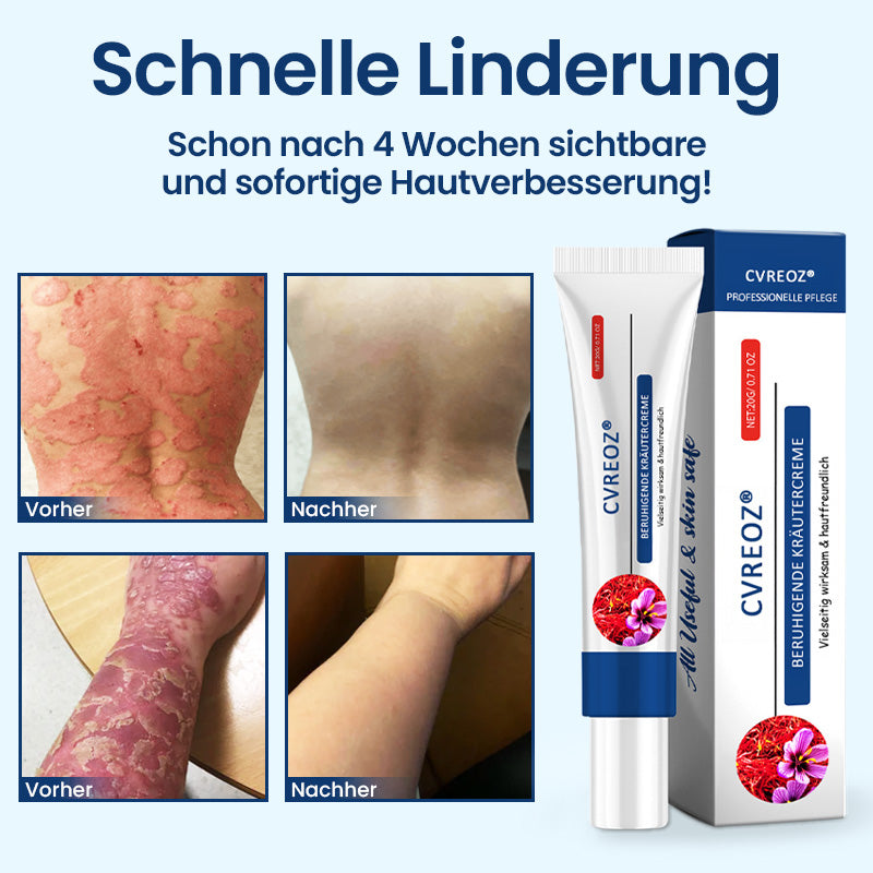 🌿CVREOZ® SootheGlow Anti-Schuppen & Juckreiz Creme