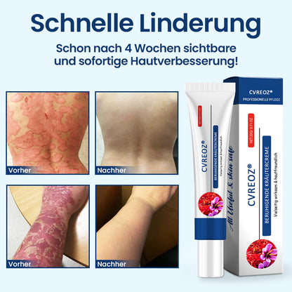 🌿CVREOZ® SootheGlow Anti-Schuppen & Juckreiz Creme
