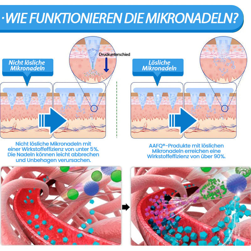 AAFQ®👑 Nano-Microneedle-Patch mit SMGT-GLP-1 & Matrixyl 3000 – Fettverbrennung, Hautstraffung, Blutzucker-Balance – ganz ohne Spritzen, sichtbare Ergebnisse in 7 Tagen