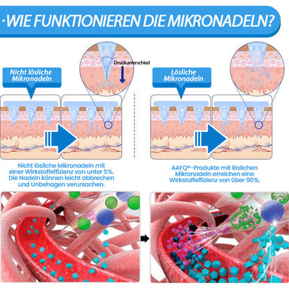 AAFQ®👑 Nano-Microneedle-Patch mit SMGT-GLP-1 & Matrixyl 3000 – Fettverbrennung, Hautstraffung, Blutzucker-Balance – ganz ohne Spritzen, sichtbare Ergebnisse in 7 Tagen
