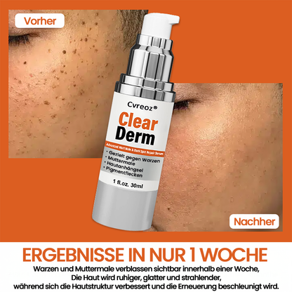 Cvreoz® ClearDerm – Serum gegen Warzen, Muttermale & Hautflecken